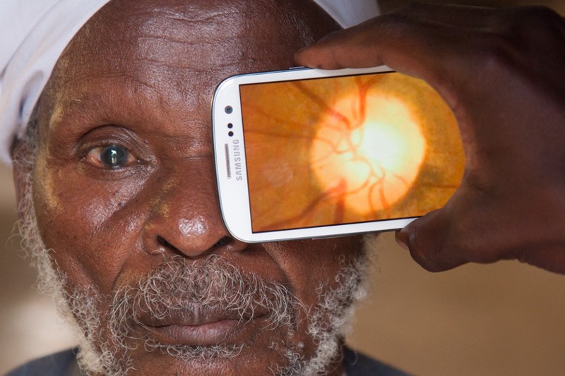 A smartphone held up to a man's eye, showing a microscopic view of the interior of his eye.