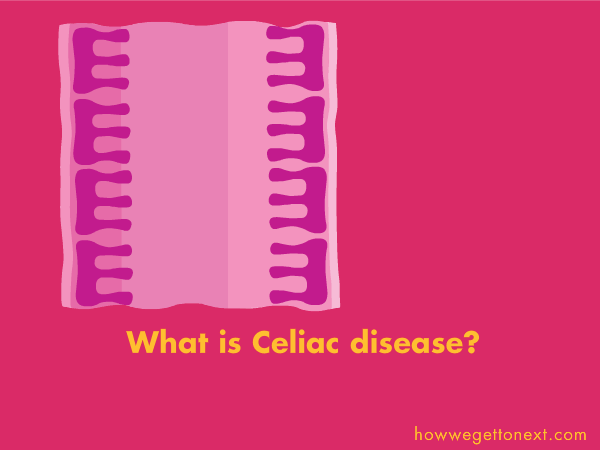 Animation entitled "what is celiac disease?" Captions read: "As food passes through your small intestine, bits get pulled out by the immune system. A sample of each protein that passes through is gets examined to see if it's dangerous. For people with celiac disease, gluten triggers an alert–even thought it's harmless. The immune system attacks the gluten, and the intestinal lining, causing cramps, diarrhea, and more."