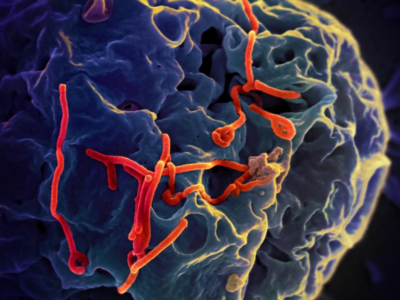 Close-up image of the Ebola virus